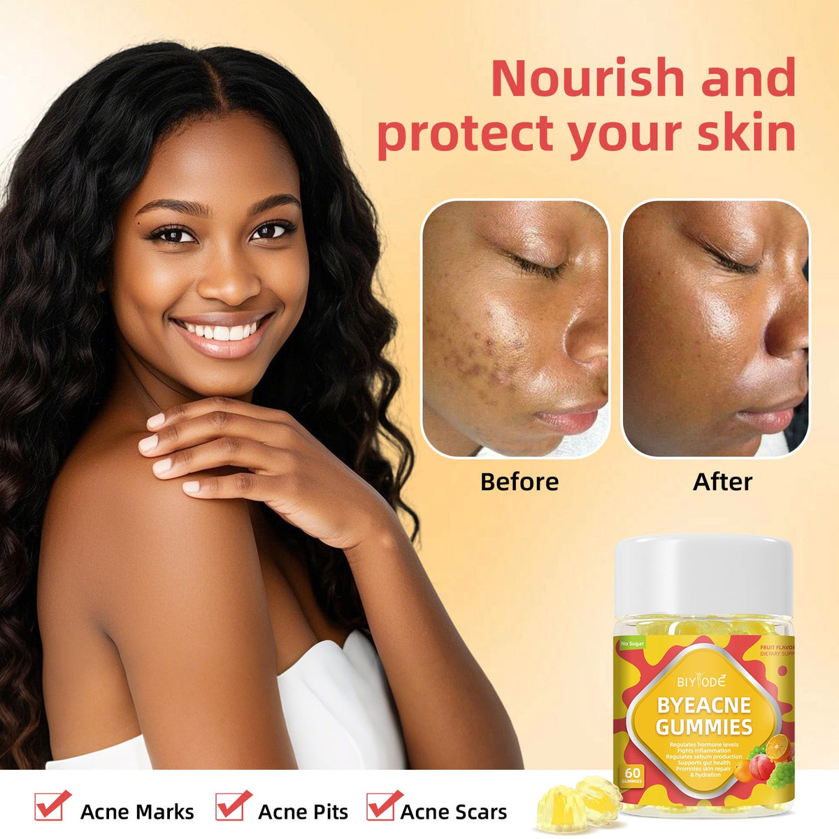 Custom Private Label ByeAcne Gummies -Hormone Balance Reduce Acne &Supports Gut Health No Sugar GMP Certified
