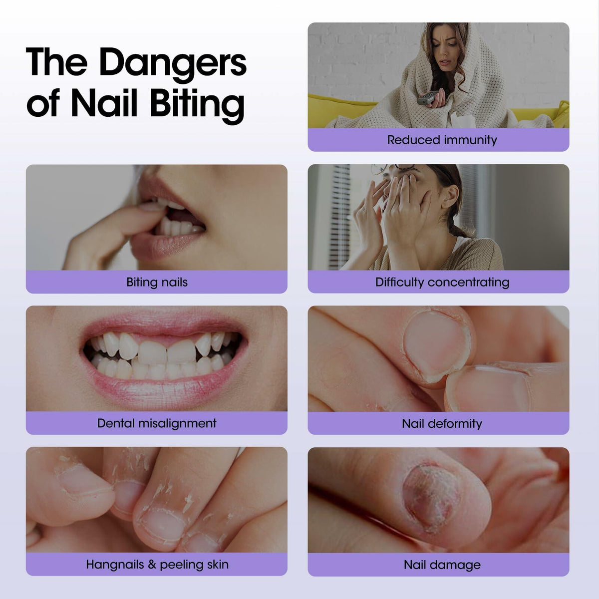 Tratamiento para morderse las uñas GELLEN Roll-On 10ml de secado rápido y resistente al agua