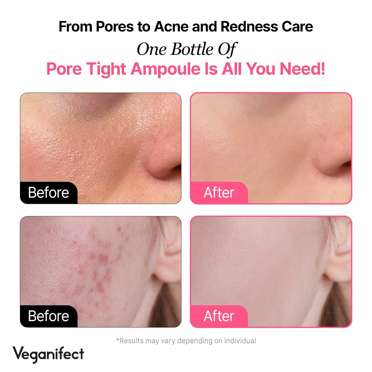 VEGANIFECT Ampolla Refinadora de Poros, Reafirmante, Reduce el Sebo 1.69oz
